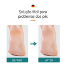 Removedor de Calos e Pele Morta Dupla Face